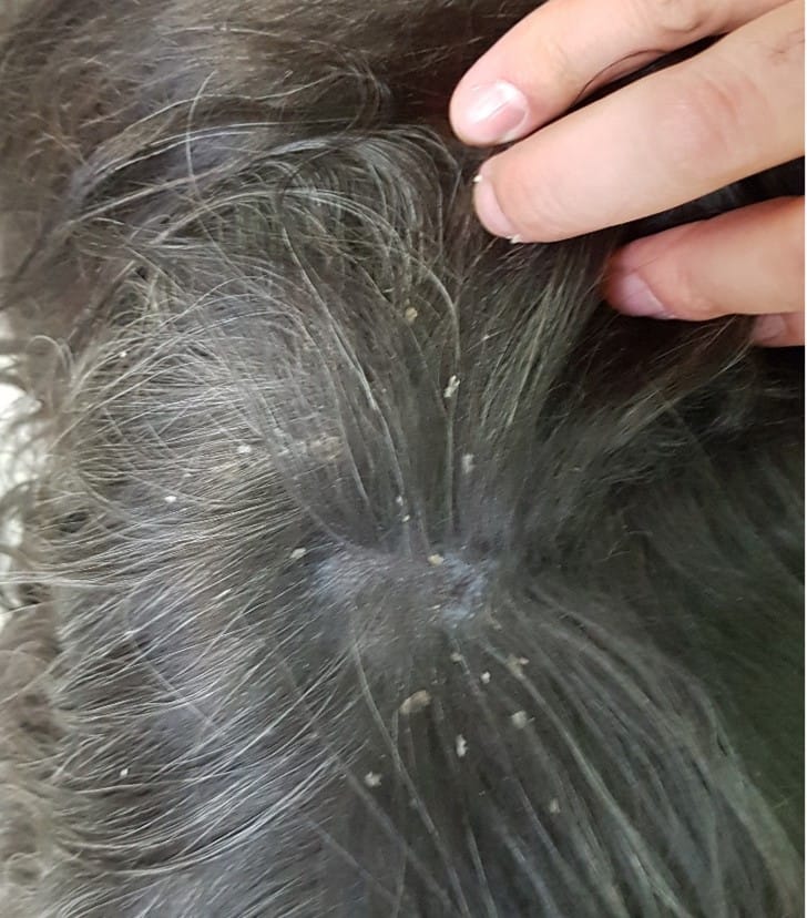 09-02.dogflakyskin1.jpg